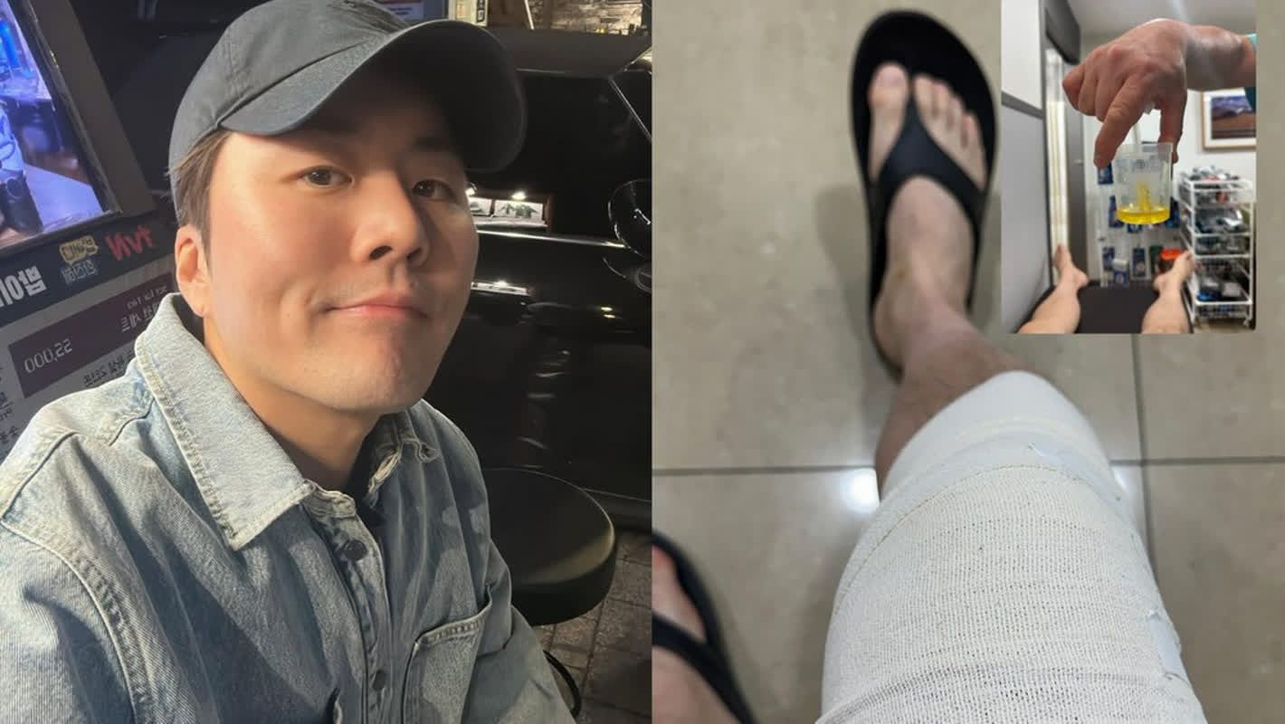 ‘음주+자숙’ 이루, 건강 위독한 상태…”몸도 마음도 만신창이” [RE:스타]