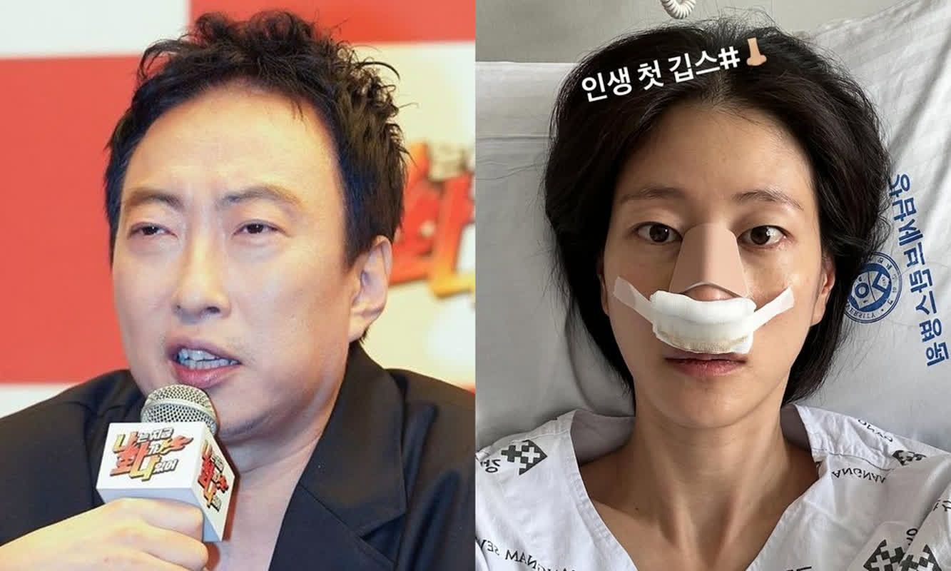 박명수, 이현이 코뼈 골절에 "코 잘 세웠네"