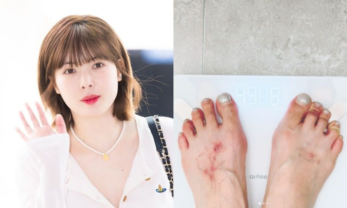 현아, 용준형과 열애 중 임신설 직접 해명
