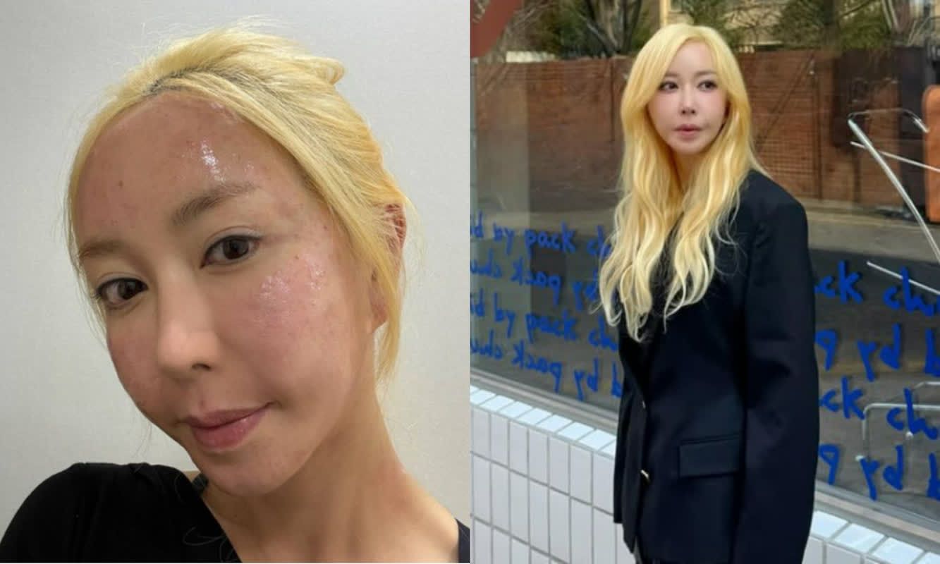 대표 이미지