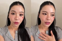 마마무 솔라, 美서 모르는 남자에 봉변…”의자 맞아 다리엔 멍” [RE:스타]