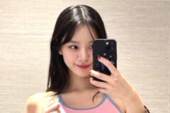 ‘의사♥’ 女스타, 인중 수술 두 달 만에 ‘대만족’→”무조건 성형해야 하는 얼굴” [RE:스타]