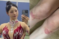 두 다리 멍 가득인데…’은퇴 15년 차’ 신수지, 방송 위해 진통제 투혼→”새로운 도전” [RE:스타]